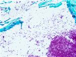 4215B | Control Slides:Histopathology; Fite, Nocardia sp., Artificial